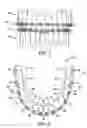 Fig. 02 - Packaged orthodontic assembly with adhesive precoated appliances