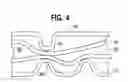 Fig. 05 - Filter media supporting apparatus and method in an engine or transmission filter