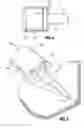 Fig. 04 - Caulking tube replacement tip