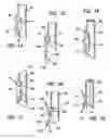 Fig. 06 - Retaining-locking system for chain link fence slats