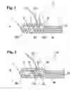Fig. 02 - Metal laminate gasket