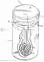 Fig. 01 - System for packaging and handling an implant and method of use