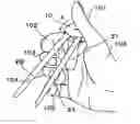 Fig. 01 - Assist tool for chopsticks