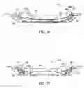 Fig. 28 - Vehicle front end structure