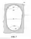 Fig. 08 - Method for manufacturing squirrel cage rotor