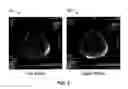 Fig. 04 - Phased array knee coil