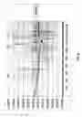 Fig. 09 - Ferromagnetic loop