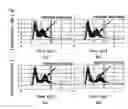 Fig. 07 - Apparatus and method for driving a plasma display panel