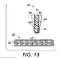 Fig. 09 - Printer wiper for printing on bichromal or multi-colored electronic paper