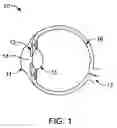 Fig. 02 - Retinal imaging system