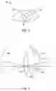 Fig. 06 - Retinal imaging system