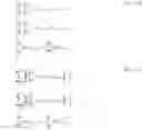 Fig. 11 - Application of neuro-ocular wavefront data in vision correction