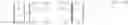 Fig. 13 - Application of neuro-ocular wavefront data in vision correction