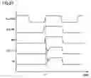 Fig. 23 - Memory device capable of stable data writing