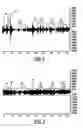 Fig. 03 - NVH dependent parallel compression processing for automotive audio systems