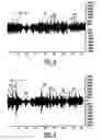 Fig. 04 - NVH dependent parallel compression processing for automotive audio systems