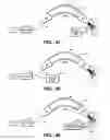 Fig. 24 - Method of providing wider window margin in an eye diagram of a received signal in a transmission system