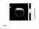 Fig. 12 - Use of particulate contrast agents in diagnostic imaging for studying physiological paramaters