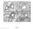 Fig. 06 - Method of treating allergen induced airway disease