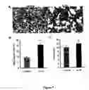 Fig. 13 - Uses of IL-12 in hematopoiesis