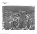 Fig. 02 - Injectable calcium salt bone filler comprising cells