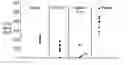 Fig. 01 - CD40 antibody formulation and methods