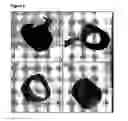 Fig. 03 - Angiogenesis inhibiting molecules, their selection, production and their use in the treatment of cancer