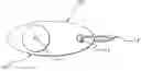 Fig. 01 - Drug delivery device with suture ring