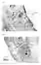 Fig. 02 - Agent for reduction of scar formation by using wound alkalinization