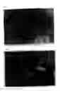 Fig. 08 - Agent for reduction of scar formation by using wound alkalinization