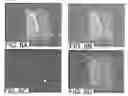 Fig. 06 - Bioconjugated nanostructures, methods of fabrication thereof, and methods of use thereof