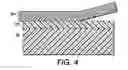 Fig. 05 - Multilayer MEMS device and method of making same