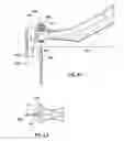 Fig. 09 - Implant positioning device and method