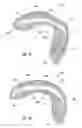 Fig. 02 - Preshaped thin-walled dental trays and methods of manufacturing and using such trays
