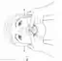Fig. 06 - Preshaped thin-walled dental trays and methods of manufacturing and using such trays