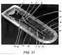 Fig. 14 - Diagnostic devices and apparatus for the controlled movement of reagents without membranes
