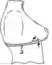 Fig. 01 - Breast support apparatus