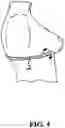 Fig. 05 - Breast support apparatus