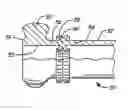 Fig. 01 - Apparatus and method for friction welded tripod interconnecting shaft