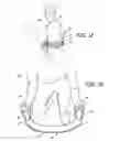 Fig. 09 - Contour elongated exercise weight and method of use