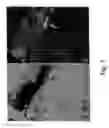 Fig. 02 - Inhibition of invasive remodelling