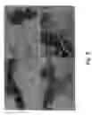 Fig. 06 - Inhibition of invasive remodelling