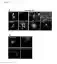 Fig. 16 - Combinations useful for the treatment of neuronal disorders
