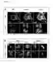 Fig. 17 - Combinations useful for the treatment of neuronal disorders