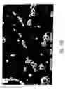 Fig. 08 - Compositions and methods for treating or preventing diseases of body passageways