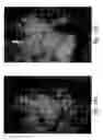 Fig. 30 - Compositions and methods for treating or preventing diseases of body passageways