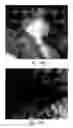 Fig. 65 - Compositions and methods for treating or preventing diseases of body passageways