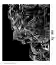 Fig. 84 - Compositions and methods for treating or preventing diseases of body passageways