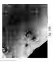 Fig. 85 - Compositions and methods for treating or preventing diseases of body passageways