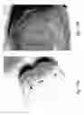 Fig. 96 - Compositions and methods for treating or preventing diseases of body passageways